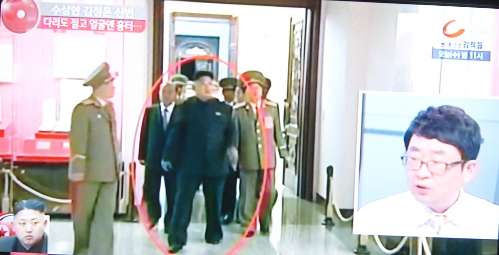 South Korean TV debate on Kim Jong-un's limping on North Korean State television while attending a memorial event commemorating the 20th anniversary of Jon Pyong Ho's death. Photo taken from South Korean TV